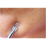 Cuill�res pour enlever les points noirs, boutons, com�dons, soulima set 7 pi�ces