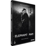 Elephant man