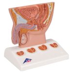 Coupe anatomique bassin masculin et maladies de la prostate