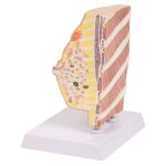 Maquette anatomique du sein avec maladies