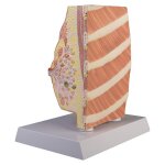 Maquette anatomique du sein avec maladies
