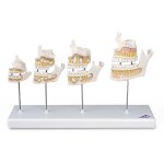 Maquette de d�veloppement de la dentition