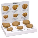 Mod�le anatomique de palpation de la prostate