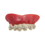 Dentier appareil dentaire