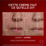 Crme visage anti - rides jour revitalift laser l'oreal paris - le pot de 50ml
