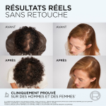 Soin anti - chute cheveux clairsemés aminexil - r elseve l'oreal paris - le flacon de 102ml Soin anti - chute cheveux clairsemés aminexil - r elseve l'oreal paris - le flacon de 102ml