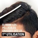Antipelliculaire cheveux gras neutrogena - le flacon de 250 ml Antipelliculaire cheveux gras neutrogena - le flacon de 250 ml