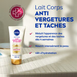 Lait anti - vergetures anti - taches hydratation 48h nivea - le flacon de 200ml