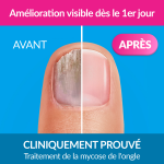 Soin pieds mycose de l'ongle extra forte excilor - le flacon de 30ml