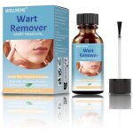 Kalanka - azote liquide anti - verrues, adapté à différents types de peau 30 ml Kalanka - azote liquide anti - verrues, adapté à différents types de peau 30 ml