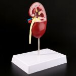 Accessoires m�dicaux, mod�le de maladie de rein humain taille r�elle, anatomie, pierre pathologique, ...