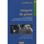 Actualit�s en imagerie du genou