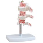 Mod�le d'anatomie de la colonne vert�brale 3 etapes, mod�le d'anatomie en pvc, enseignement et recherche ...