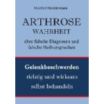 Arthrose