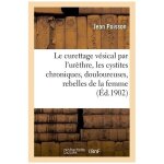 Le curettage v�sical par l'ur�thre : pour cystites chroniques, douloureuses, rebelles chez la femme