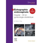 Echographie endovaginale - doppler - 3d en gynécologie - obstétrique Echographie endovaginale - doppler - 3d en gynécologie - obstétrique