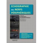 Echographie des nerfs p�riph�riques
