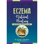 Eczema
