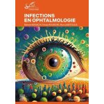 Infections en ophtalmologie Infections en ophtalmologie