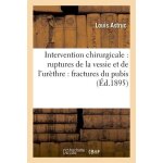Intervention chirurgicale, ruptures de la vessie & de l'ur�thre cons�cutives aux fractures du pubis