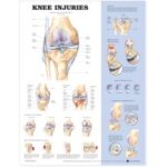 Knee injuries Knee injuries