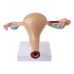 Modle d'ovaire de l'utrus physiologique humain, anatomie de la maladie pathologique de la lsion, pour ...