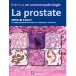 La prostate