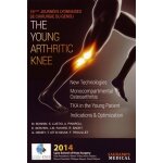 The young arthritic knee - 16�mes journ�es lyonnaises de chirurgie du genou