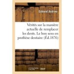 Quelques v�rit�s sur la mani�re actuelle de remplacer les dents - le bon sens en proth�se dentaire