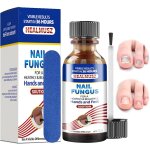 30ml traitement de la mycose de lâ¿ongle, solution mycose ongle, facile & rapide, réparatrices, ongles ... 30ml traitement de la mycose de lâ¿ongle, solution mycose ongle, facile & rapide, réparatrices, ongles ...