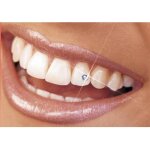 Diamant dentaire strass dent bijoux - beaut bouche star
