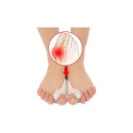 Correcteur d'hallux valgus [6x] silicone amlior, taille unique - sparateur d'orteils, redresseur, ...