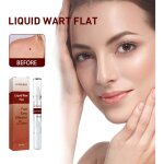 Stylo liquide pour enlever les verrues limination des grains de beaut pour les verrues filiformes 3 ...