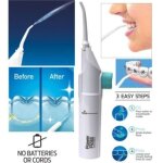 Nettoyeur de dents jet d'eau nettoyage dentaire hygine bucco - dentaire