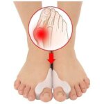Correcteur d'hallux valgus [6x] silicone am�lior�, taille unique - s�parateur d'orteils, redresseur, ...