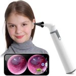 Otoscope, otoscope hd sans fil ultra - fin avec lumi�re, nettoyeur d'oreilles avec contr�le de la temp�rature ...