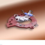 �lectrodes allumage de chaudi�re ? kit pi�ces m�tal et c�ramique ? compatible chaudi�res elm leblanc ...