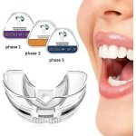 3 phases dentaire orthodontique correcteur de dents accolades dents correctes myobrace - choyclit