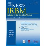 Irbm news