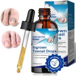 30ml professionnel soin d?ongle mycose de longlepour les ongles d�color�s �paissiscontre la mycose de ...