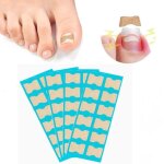 48 pi�ces - pansements correcteurs respirants - sans colle - correcteur indolore pour ongles incarn�s ...