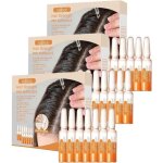 Croissance des cheveux repousse des cheveux perte de cheveux repousse paississante lotion srum de croissanc ...