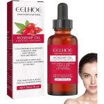 Huile de rose musquée huile de rose musquée pressée à froid pour la peau - huile de soin hydratante pour ... Huile de rose musquée huile de rose musquée pressée à froid pour la peau - huile de soin hydratante pour ...