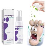 Spray antifongique medinail - traitement de la mycose des ongles - renforce les ongles