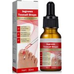 Traitement des ongles incarn�s - 30ml ongles incarn�s - huiles de soin des cuticules pour les ongles ...