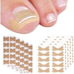 100pcs ongle incarn� kitkit de correction dongles incarn�scorrection des ongles des orteils incarn�sorteil ...
