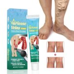 1pcs varices crme crme rparatrice pour les varices veines araignes traitement crme crme anti - ...