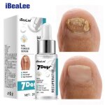 20ml - ibealee 7 jours rparation mycose des ongles traitements essence soins des pieds srum orteil ...
