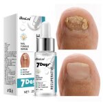 20ml - ibealee srum de rparation des champignons des ongles 7 jours essence de traitement des pieds ...