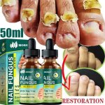 30ml - rparatrice soins des pieds traitement des mycoses des ongles lonychomycosis paronychia antifongique ...
